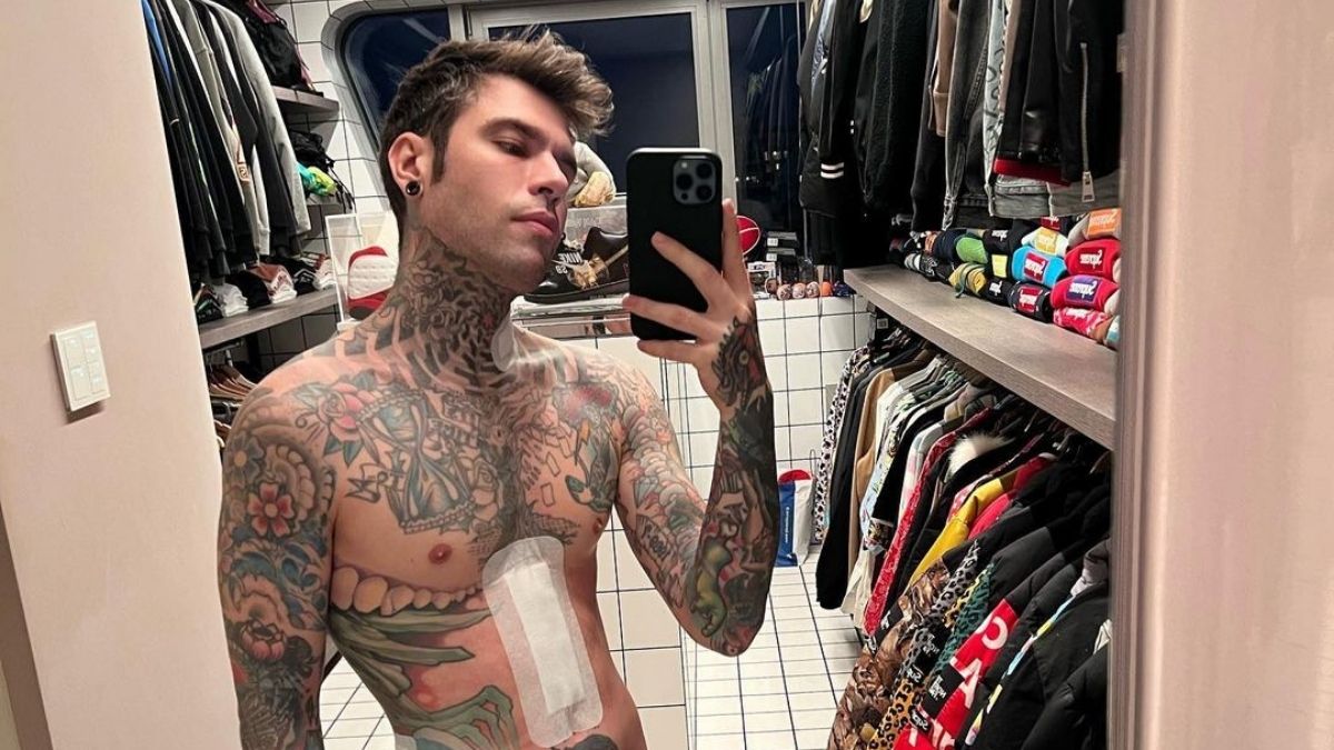 Fedez cicatrice